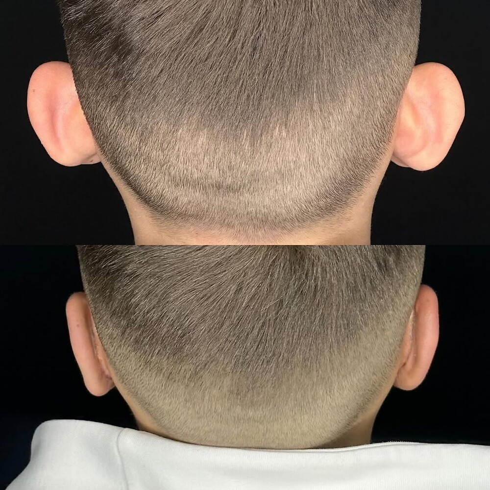 Before and After Result